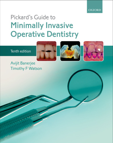 Pickard's guide to minimally invasive operative dentistry