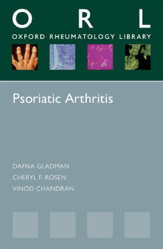 Psoriatic arthritis