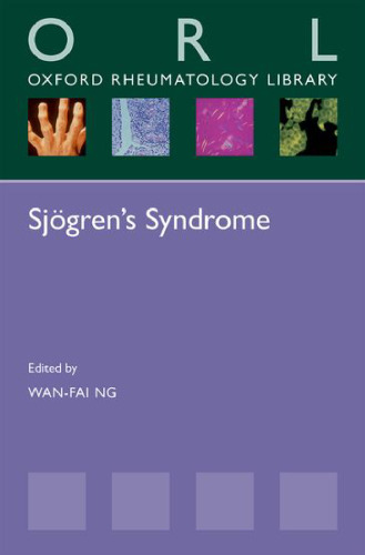 Sjögren’s Syndrome