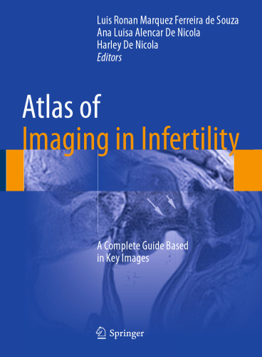 Atlas of Imaging in Infertility: A Complete Guide Based in Key Images