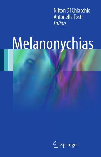 Melanonychias