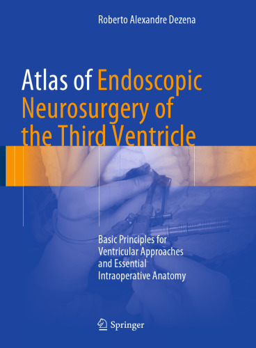 Atlas of Endoscopic Neurosurgery of the Third Ventricle: Basic Principles for Ventricular Approaches and Essential Intraoperative Anatomy