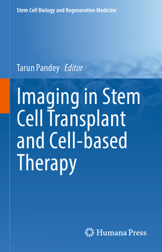 Imaging in Stem Cell Transplant and Cell-based Therapy