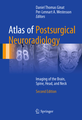 Atlas of Postsurgical Neuroradiology: Imaging of the Brain, Spine, Head, and Neck