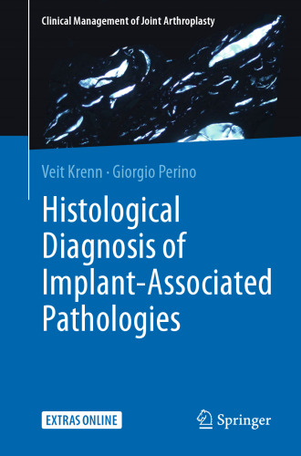 Histological Diagnosis of Implant-Associated Pathologies