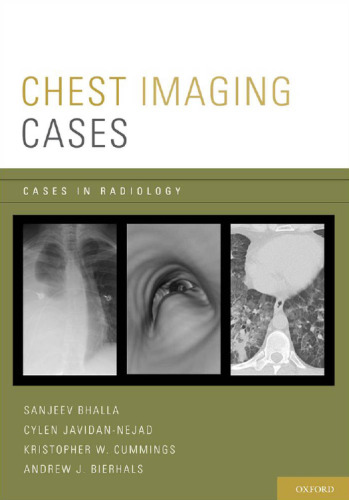 Chest imaging cases