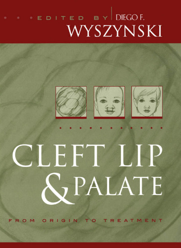 Cleft lip and palate : from origin to treatment