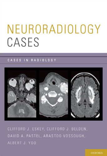 Neuroradiology cases