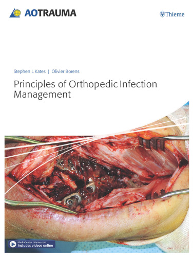 Principles of orthopedic infection management