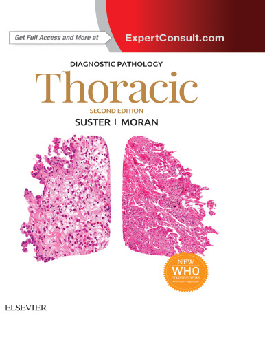 Thoracic