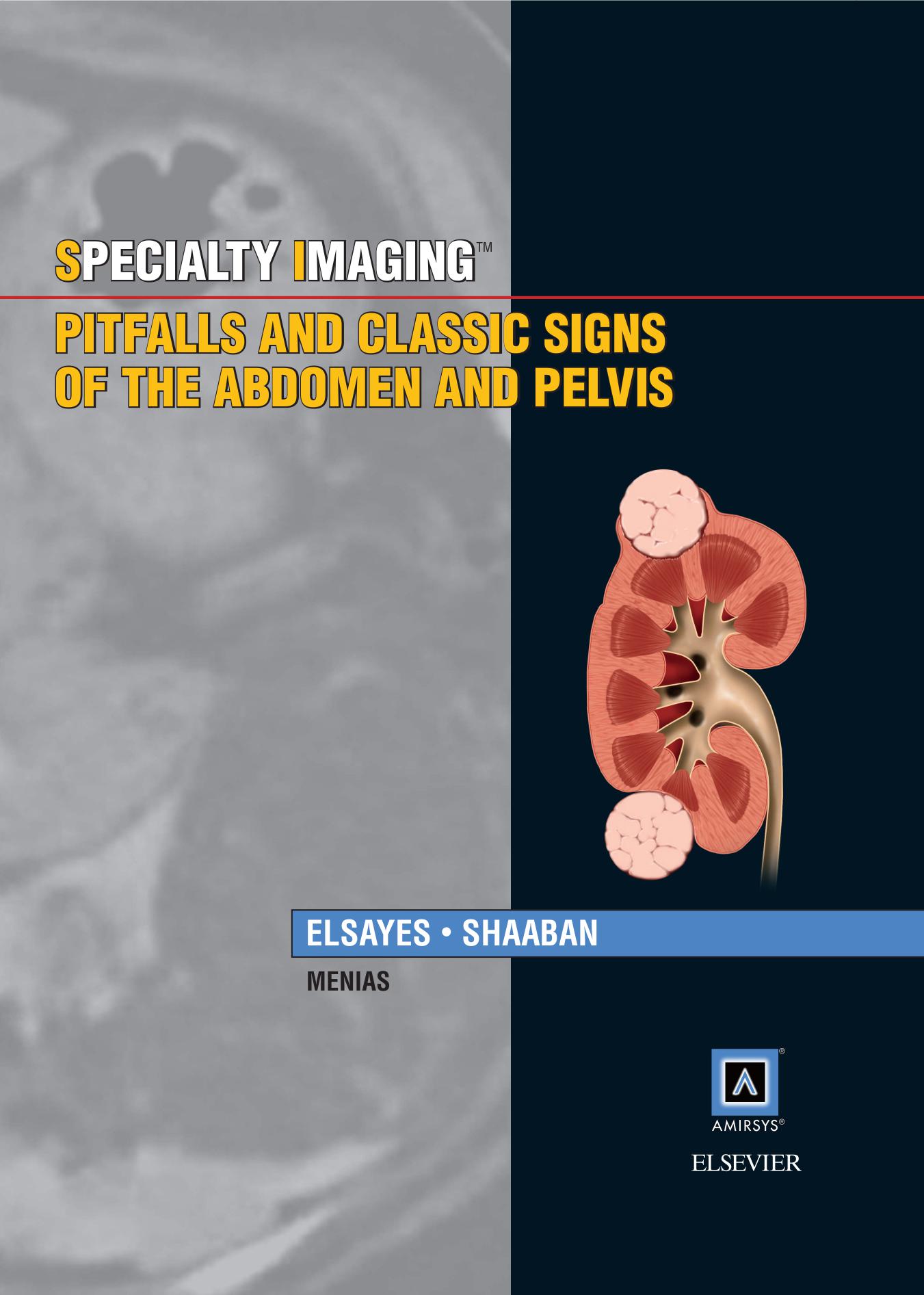 Pitfalls and classic signs of the abdomen and pelvis