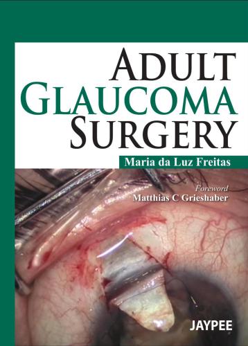 Adult Glaucoma Surgery