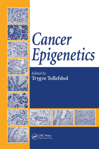 Cancer Epigenetics