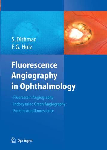 Fluorescence Angiography In Ophthalmology