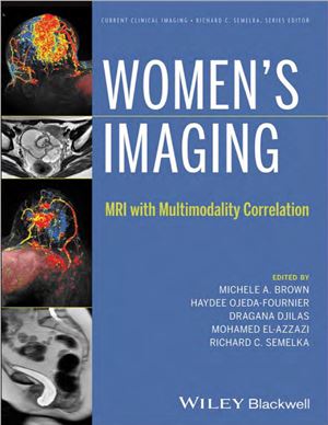 Women's Imaging: MRI with Multimodality Correlation