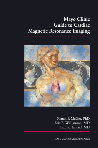 Mayo Clinic Guide to Cardiac Magnetic Resonance Imaging