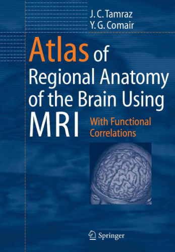 Atlas of Regional Anatomy of the Brain Using MRI: With Functional Correlations