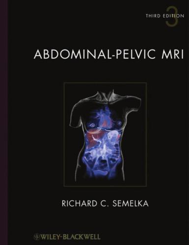 Abdominal-Pelvic MRI. Vol.1