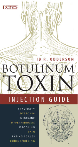 Botulinum Toxin Injection Guide