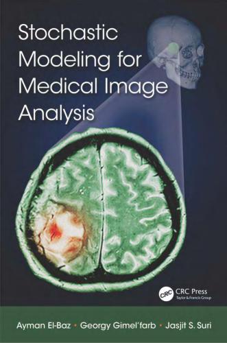 Stochastic Modeling for Medical Image Analysis