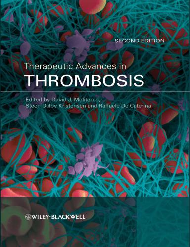 Therapeutic Advances in Thrombosis