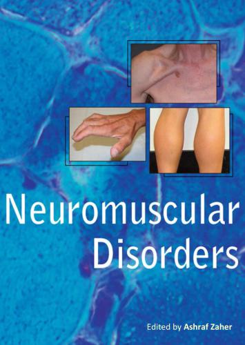 Neuromuscular Disorders