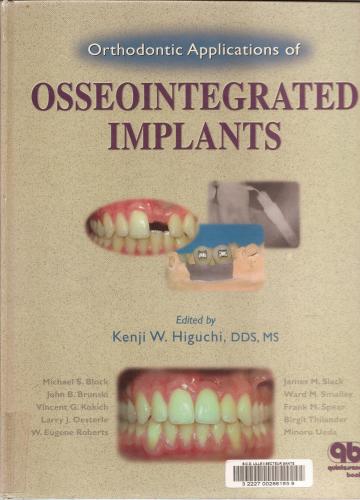 Orthodontic Applications of Osseointegrated Implants