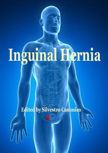 Inguinal hernia