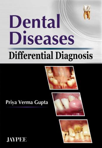 Differential Diagnosis of Dental Diseases