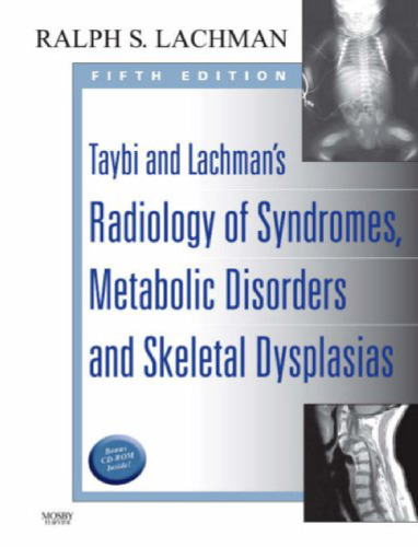 Taybi and Lachman’s Radiology of Syndromes, Metabolic Disorders and Skeletal Dysplasias