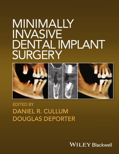 Minimally invasive dental implant surgery