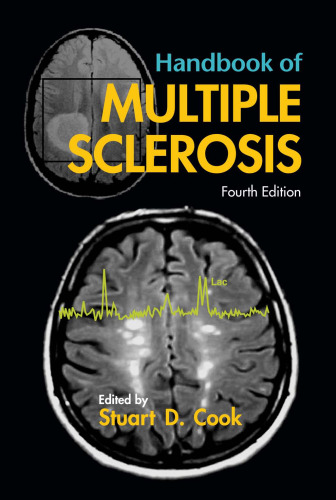 Handbook of Multiple Sclerosis