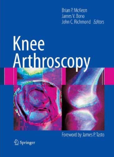 Knee Arthroscopy