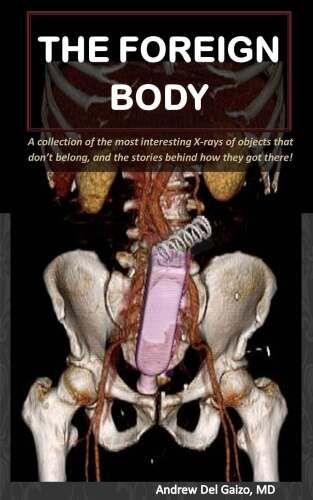 The Foreign Body: A collection of the most interesting X-rays of things that don't belong and the stories behind how they got there!