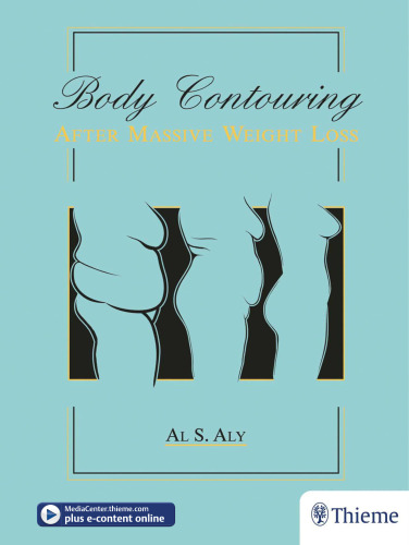 Body Contouring after Massive Weight Loss