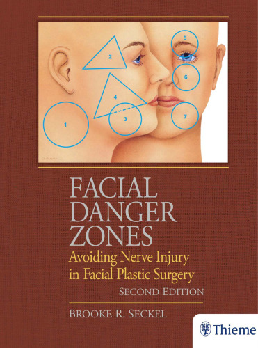 Facial Danger Zones: Avoiding Nerve Injury in Facial Plastic Surgery