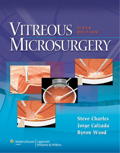 Vitreous Microsurgery