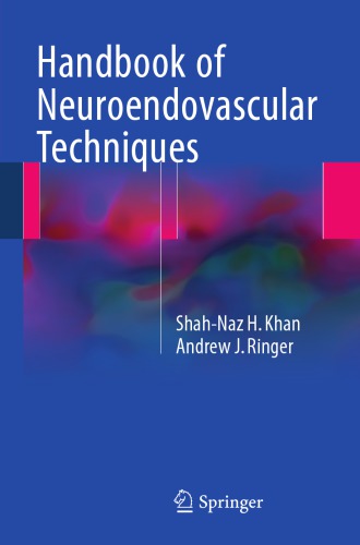 Handbook of neuroendovascular techniques