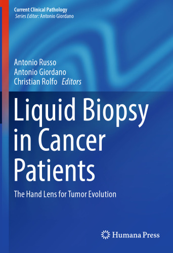 Liquid biopsy in cancer patients : the hand lens for tumor evolution