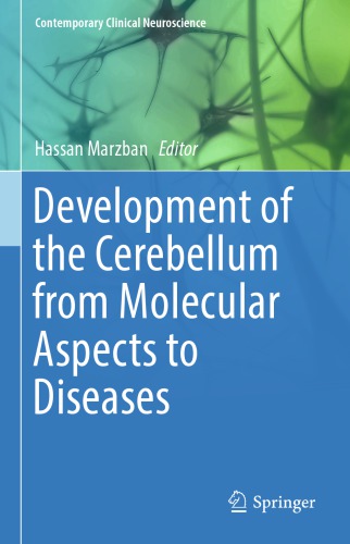 Development of the Cerebellum from Molecular Aspects to Diseases