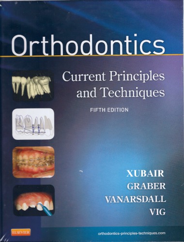 Orthodontics: Current Principles and Techniques