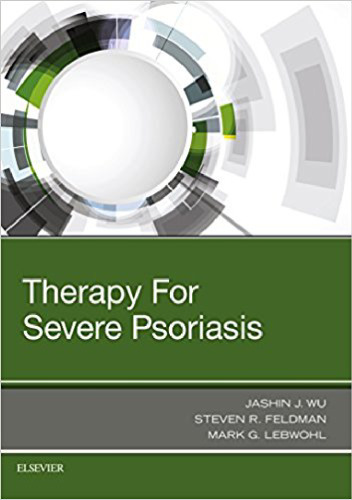 Therapy for Severe Psoriasis