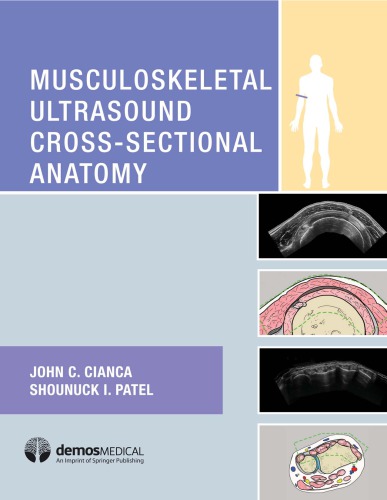 Musculoskeletal Ultrasound Cross-Sectional Anatomy