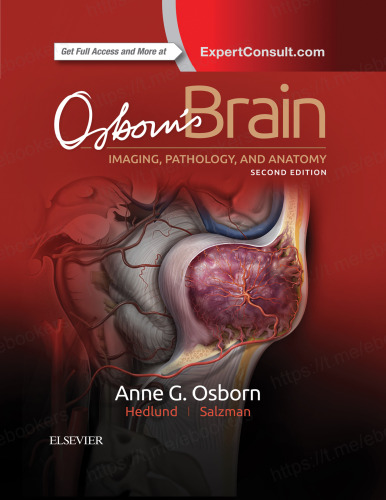 Osborn’s Brain: imaging, pathology, and anatomy