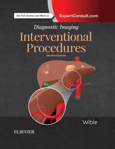 Interventional Procedures