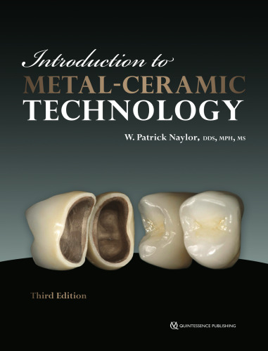 Introduction to Metal-Ceramic Technology