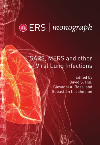 SARS, MERS and other Viral Lung Infections