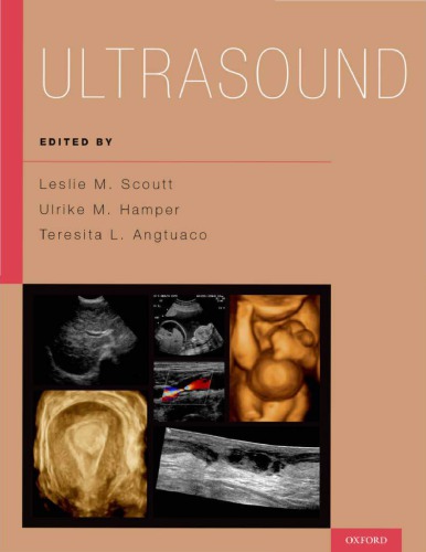 Ultrasound