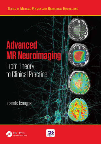 Advanced MR Neuroimaging: From Theory to Clinical Practice