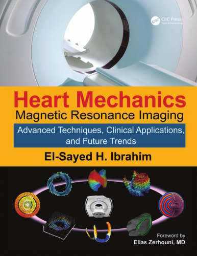 Heart mechanics : magnetic resonance imaging